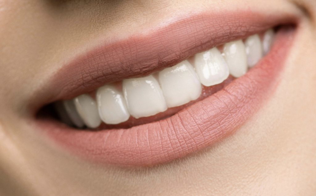 PAP en blanqueamiento dental