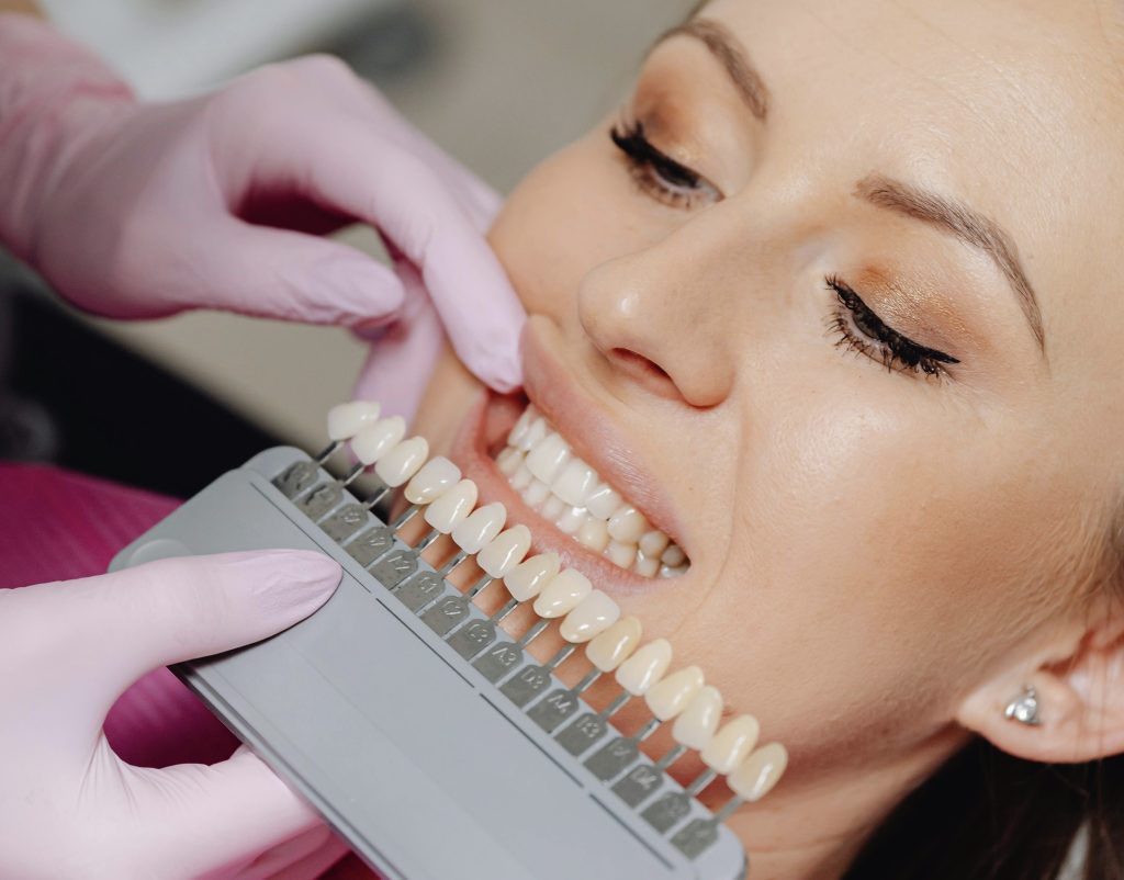 Peróxido de hidrógeno en blanqueamiento dental